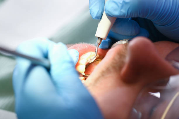 Best Urgent Dental Care for Toothache in Lincolnia, VA
