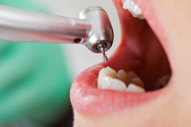 Best Pediatric Emergency Dentist in Lincolnia, VA